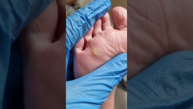 Израильский институт #FANIBENAMI создали средства, которые решат многие проблемы рук, ног, ногтей? смотреть онлайн