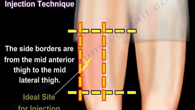 Vastus Lateralis Intramuscular Injection - Everything You Need To Know - Dr. Nabil Ebraheim смотреть онлайн