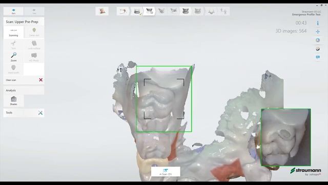 3shape TRIOS - Straumann Implant Scanning Workflow смотреть онлайн