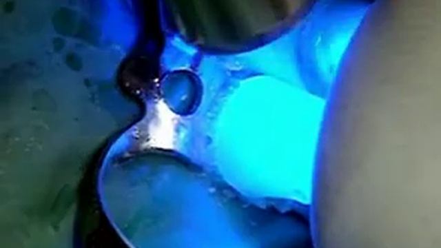 Лечение корня, морфология корневого канала.flv смотреть онлайн