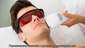 Лазерная эпиляция бровей