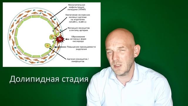 АТЕРОСКЛЕРОЗ смотреть онлайн