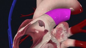 Анатомия сердца / Камеры сердца / Гемодинамика / Ангиология