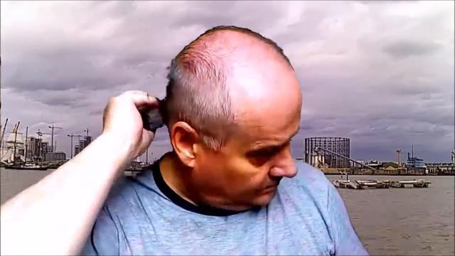 Haircut For Balding Men #AtHome Male Pattern Baldness - Thinning Hair - Buzz Cut 😂😂👍
