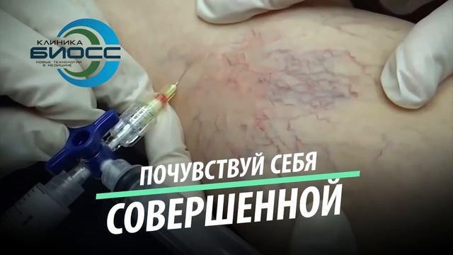 Волшебство антиварикозного укола. смотреть онлайн