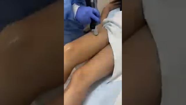 Motus AX - DEKA (Alexandrite)!! EXCELLENT RESULTS IN MINIMUM SESSION!! смотреть онлайн