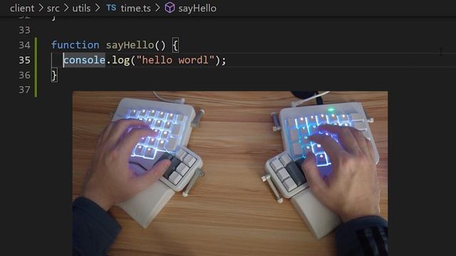 5 Years of Split Keyboards Behind Me - My Review смотреть онлайн