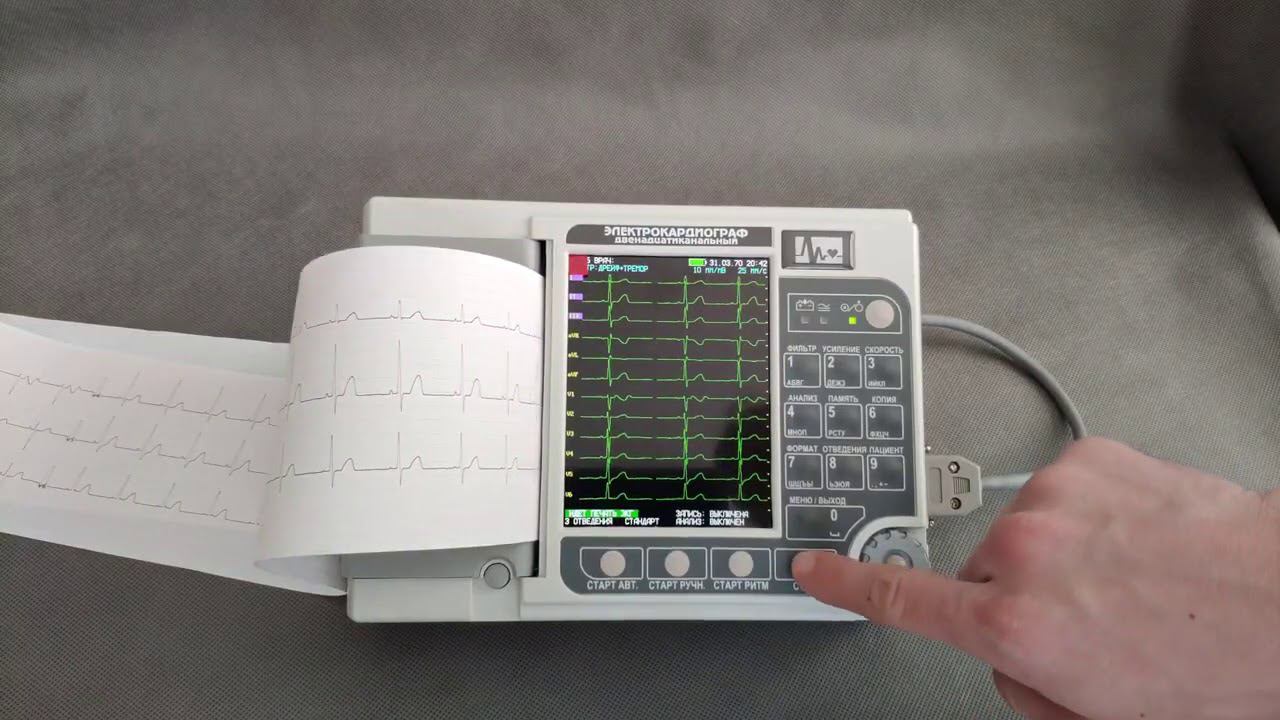 Электрокардиограф ЭК12Т-01-"Р-Д" смотреть онлайн