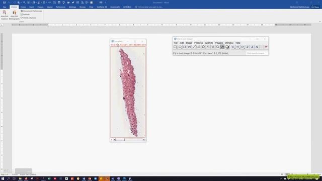 How to convert SVS files to Tiff, JPG or PNG смотреть онлайн