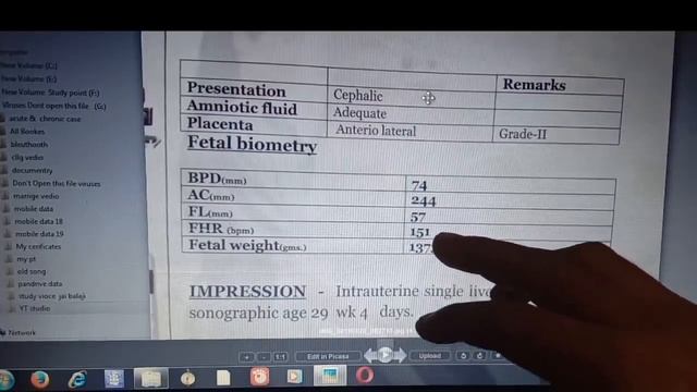 How To Read Pregnancy Ultrasounds (USG) At Home | घर पर प्रेगनेन्सी अल्ट्रासाउंड कैसे देखें смотреть онлайн