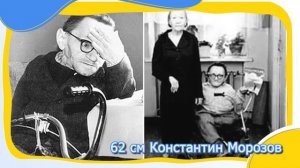 Топ 10 Самых маленьких людей в мире