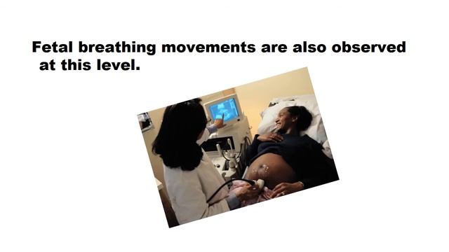2 and 3 trimester normal for sonographers. смотреть онлайн