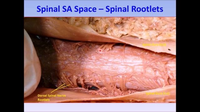 SPINAL CORD NERVE ROOTLETS Dura Arachnoid Subarachnoid Space and Clinicals – Sanjoy Sanyal смотреть онлайн