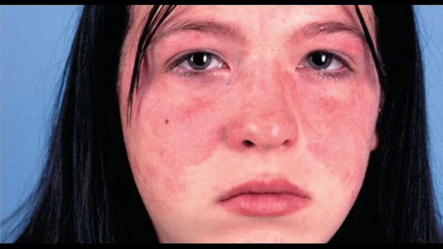 8 вещей, которые может рассказать лицо о здоровье. смотреть онлайн