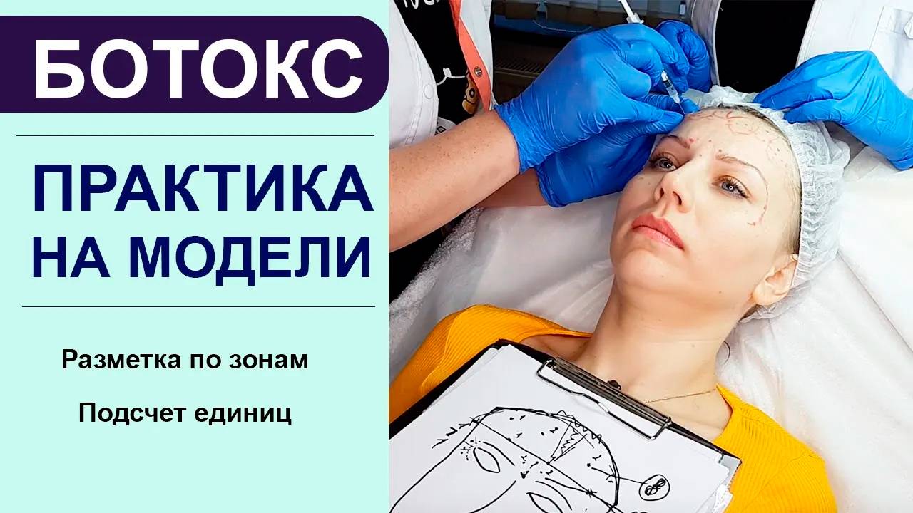 ПРАКТИКА ботокс на модели - разметка по зонам, подсчет единиц смотреть онлайн