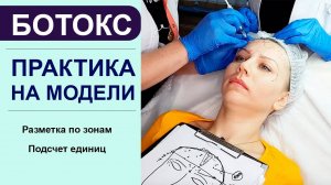 ПРАКТИКА ботокс на модели - разметка по зонам, подсчет единиц