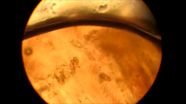 Gyrodactylus on gill смотреть онлайн