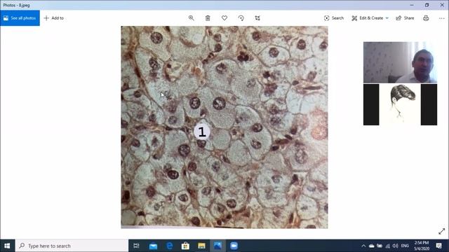 Patoloji anatomiya kafedrası – Qaraciyər xəstəlikləri (Praktik məşğələ №7) смотреть онлайн