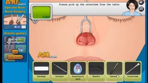 Operate Now! - NOSE SURGERY
