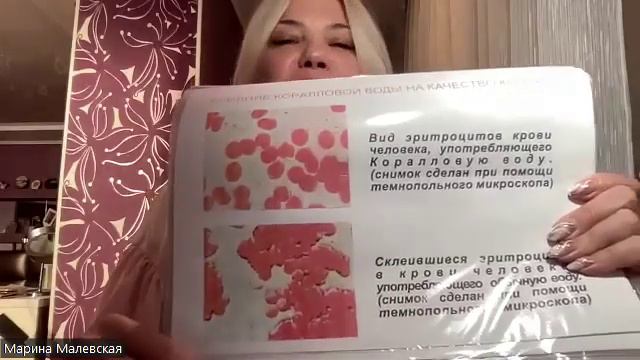 Корал Детокс. Невероятные результаты. смотреть онлайн