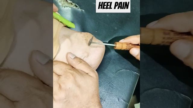Heel Pain remove instant #viral #shortsfeed #shortvideo #youtubeshorts #ytshorts #shorts смотреть онлайн
