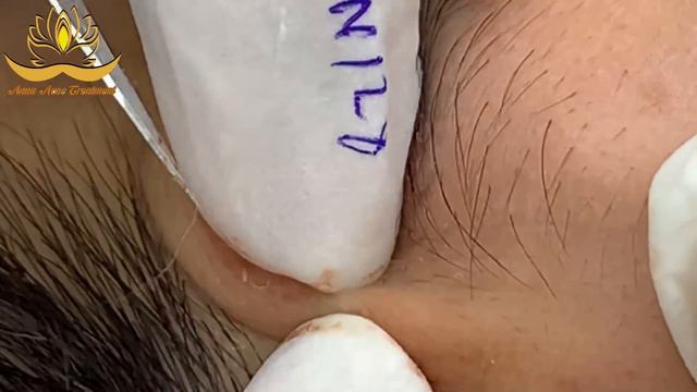 Most Satisfying and Relaxation with An Spa Video #084 смотреть онлайн