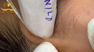 Most Satisfying and Relaxation with An Spa Video #084