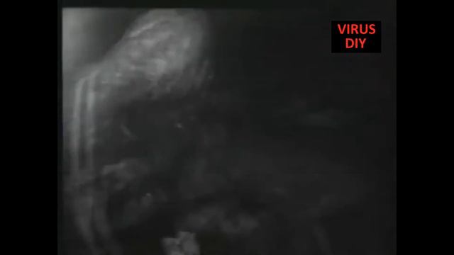 Virus DIY - что это такое и насколько это опасно смотреть онлайн