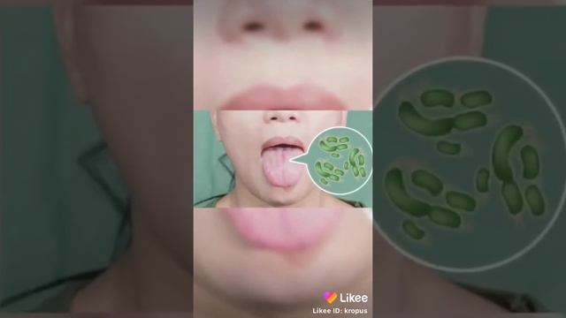 Что будет если ты будешь грызть ногти