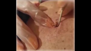 # 11 ШОООК Большой жировик\КАМЕДОН\Большой жировик