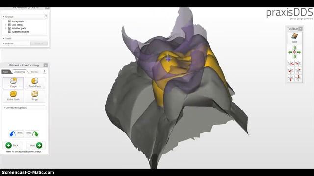 praxisdds Design software - powered by exocad смотреть онлайн