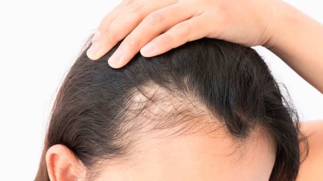 Почему болят корни волос смотреть онлайн