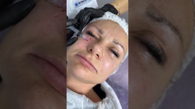 Препарат: AGT M Eye Polyrevitalizing Complex