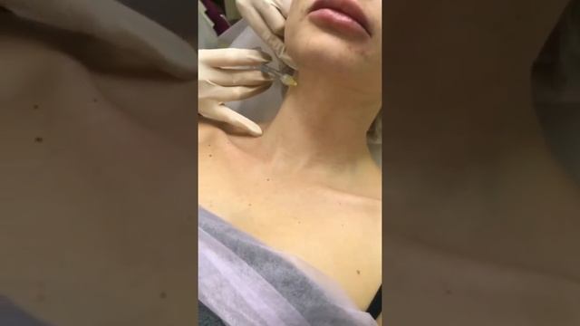 Убираем морщины и возрастные изменения на шеи смотреть онлайн