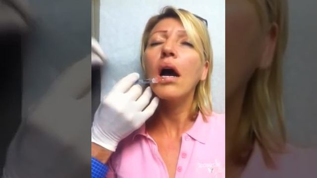 Dr Chappel injects Restylane after numbing смотреть онлайн