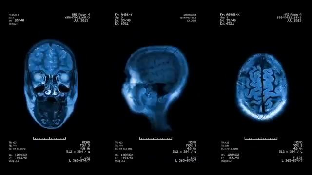 Жизнь - это Сознание. Доктор Тони Нейдер. смотреть онлайн