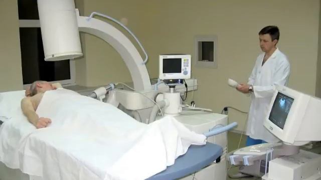 Дробление камней в почках смотреть онлайн