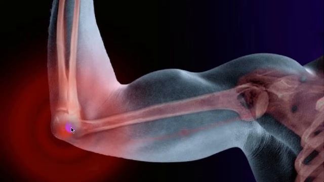 Почему чувствуем боль током при ударе локтем смотреть онлайн