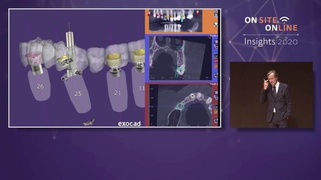 Patient case "Patrick" and live surgery at exocad Insights 2020 смотреть онлайн