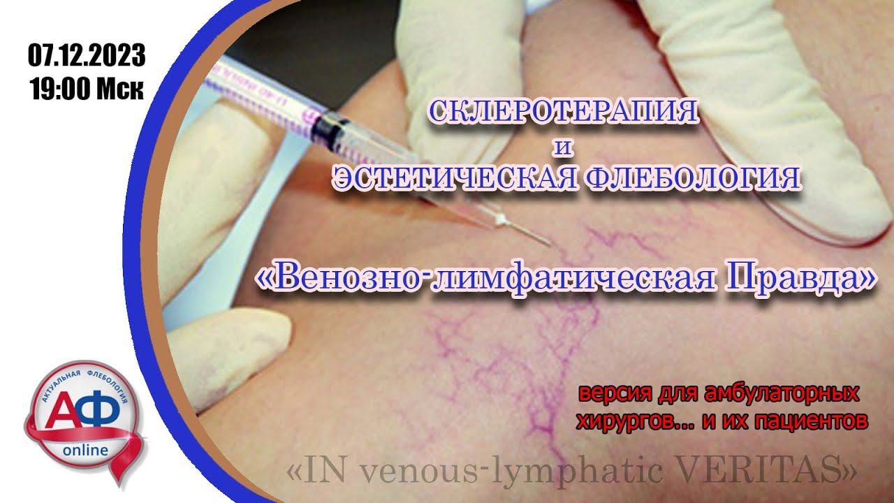 Склеротерапия и эстетическая флебология Венозно-лимфатическая правда. Эфира для хирургов и пациентов смотреть онлайн