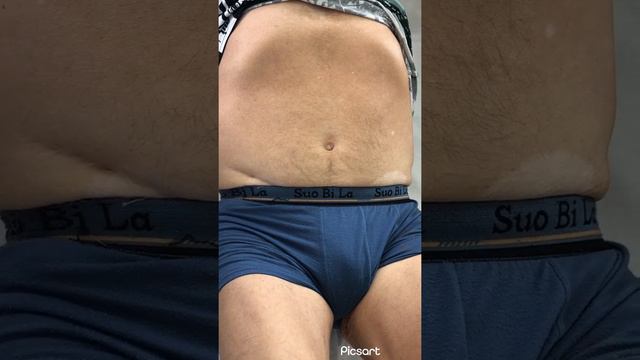 Уроки пропедевтики (пальпация и аускультация брюшной аорты и ее ветвей) #лекции