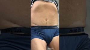 Уроки пропедевтики (пальпация и аускультация брюшной аорты и ее ветвей) #лекции