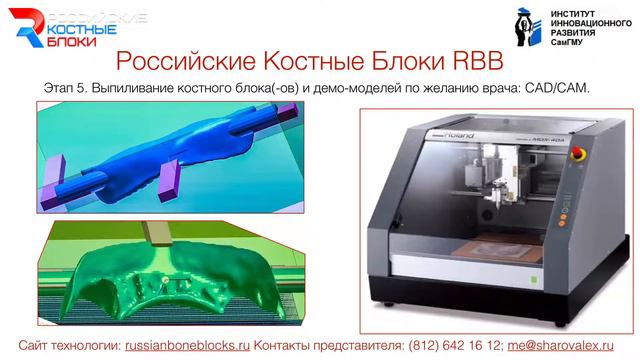 Российские Костные Блоки RBB Russian Bone Blocks смотреть онлайн