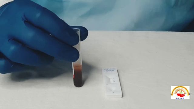 #TYPHIDOT Rapid Test IgG/IgM смотреть онлайн