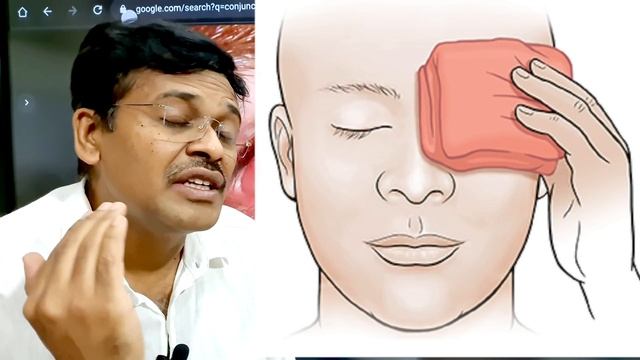 madras eye treatment symptoms home remedies in tamil ! | dr karthikeyan смотреть онлайн
