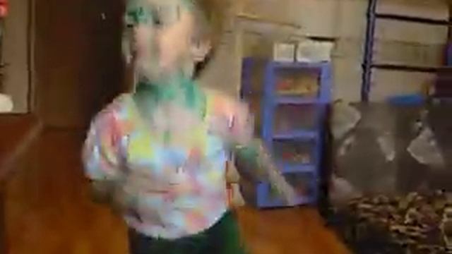 After a chicken pox смотреть онлайн