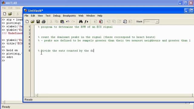 Signal Analysis using Matlab - A Heart Rate example смотреть онлайн
