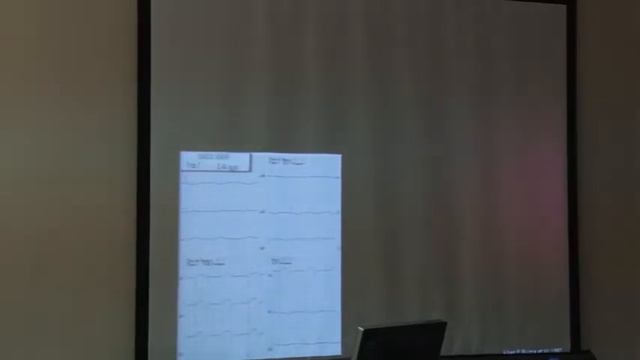 Кардиологическая секция серд.-сосуд. хирургов РФ смотреть онлайн