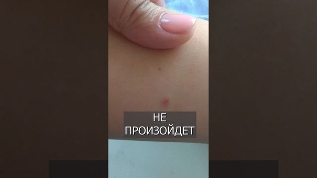 МАНТУ можно МОЧИТЬ. Все эти годы нас обманывали смотреть онлайн