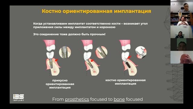 May 17th Minimally Invasive Implant Treatment смотреть онлайн